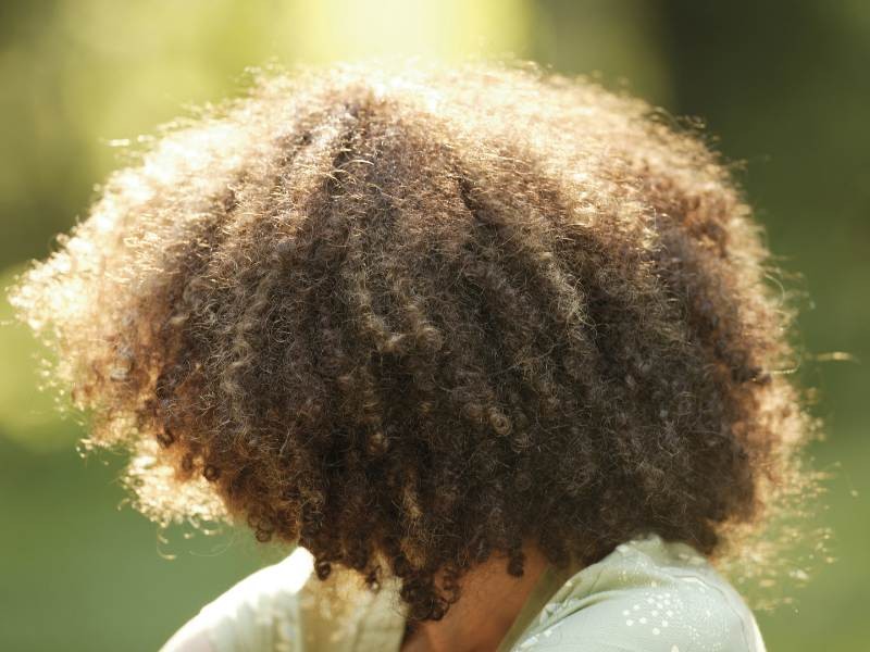 Transplante capilar em pessoas com cabelos crespos e cacheados: particularidades, técnica e resultados