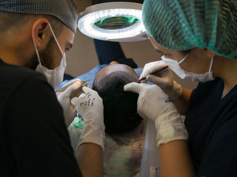 Idade ideal para fazer o transplante capilar: qual o melhor momento?